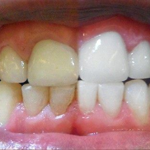  HOW HEALTHY ARE YOUR GUMS AND TEETH?